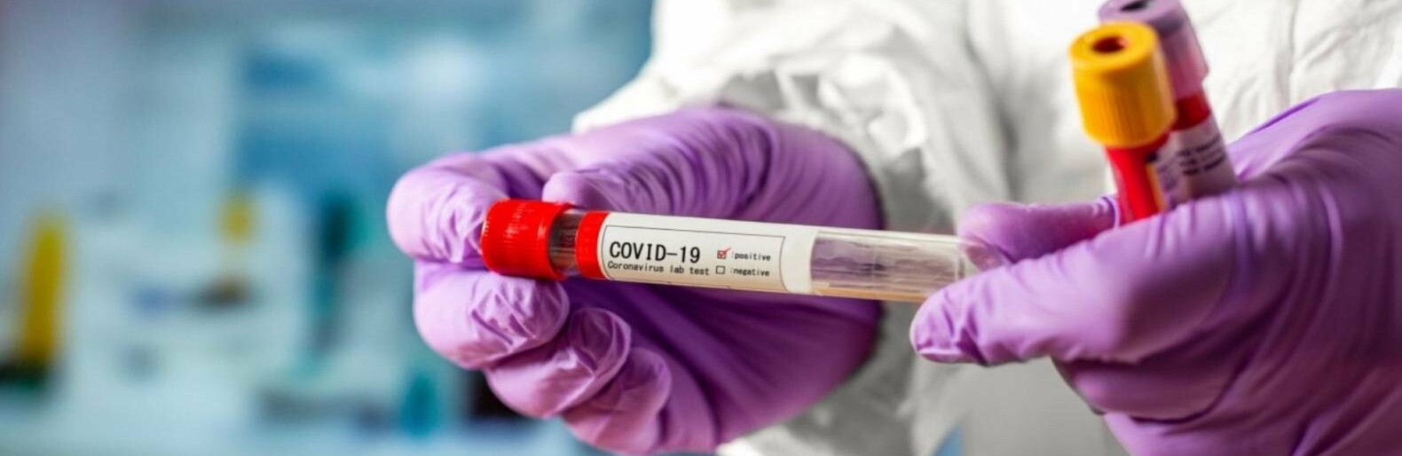 COVID-19: в Мелитополе 6 новых случаев и 3 смерти от инфекции